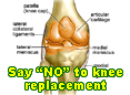 Say "No" to Knee replacement