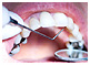 Dental Turism - Ayurtoday